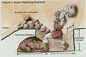 Giant Fighting Position